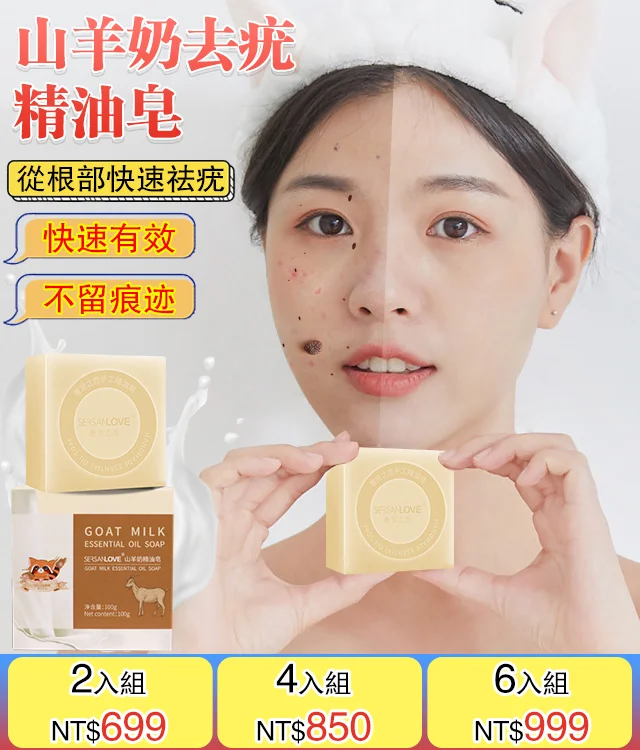 山羊奶去疣精油皂無需手術 衹需一洗輕鬆解决問題