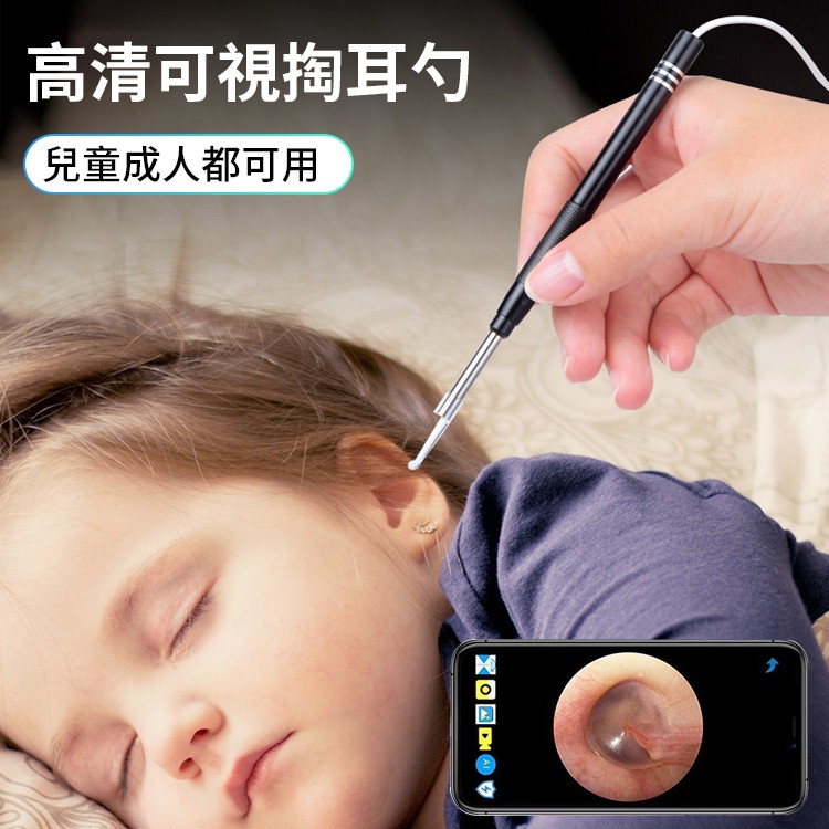 超清可視掏耳勺【安全採耳新體驗】高清可視掏耳勺，兒童成人都可用！