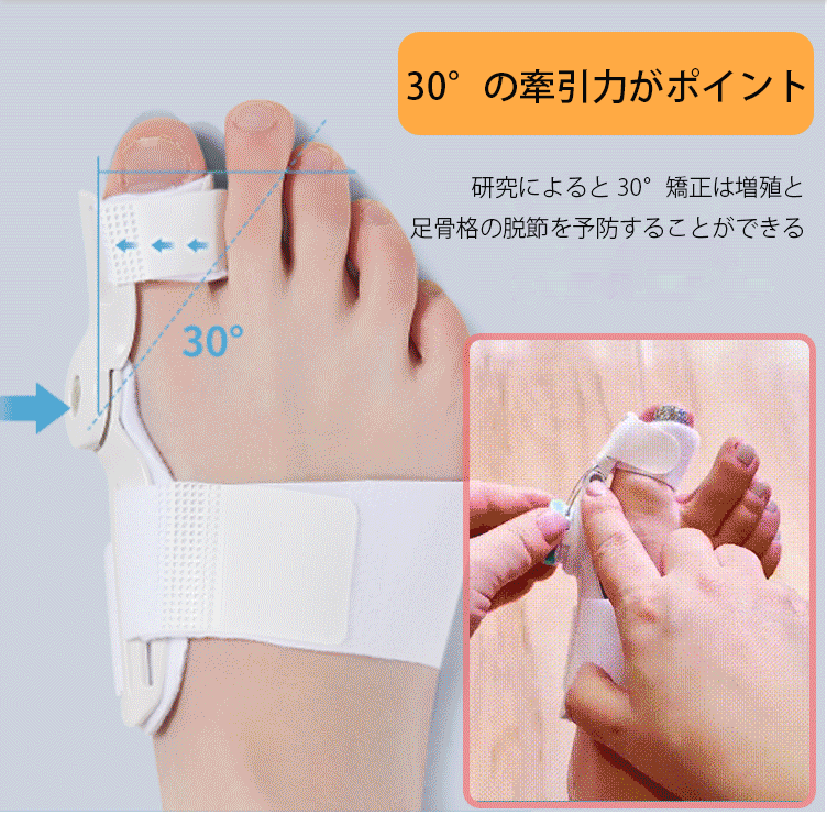 日本骨科醫生推薦】Tenicore獨家3D旋調整骨拇指外翻矯正器, 科學矯正不傷骨